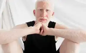 Rever D Albinos Islam Signification Interpretations Nombreuses